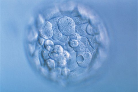 http://yantai.quanwangkm.com/post/190.html|烟台人工试管